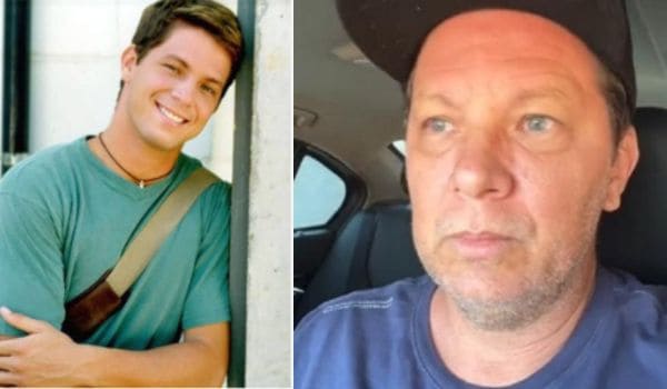 Foto do antes e depois de Mário Frias